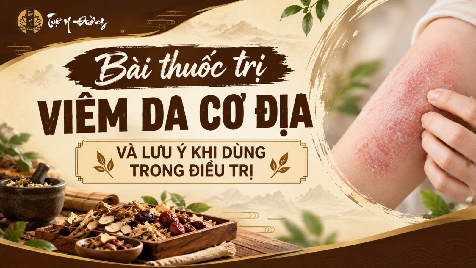 Bài thuốc trị viêm da cơ địa và lưu ý dùng trong điều trị