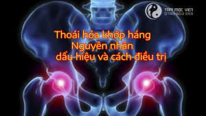 Thoái hóa khớp háng