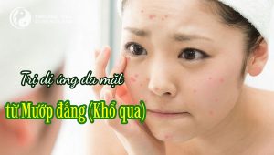 KHỔ QUA (MƯỚP ĐẮNG)