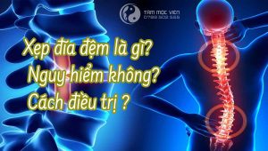 Xẹp đĩa đệm cột sống