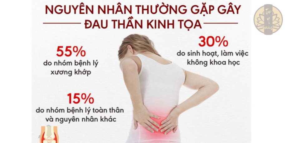 Có nhiều nguyên nhân dẫn đến đau thần kinh tọa 