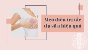 Meo điều trị tắc tia sữa hiệu quả