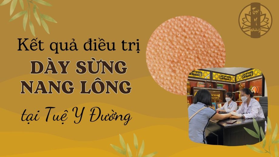 Kết quả điều trị dày sừng nang lông