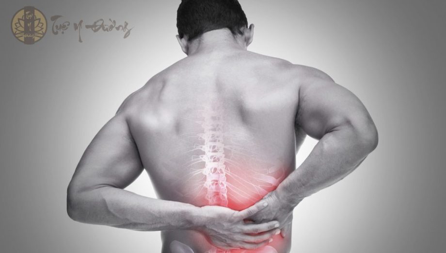 Giãn dây chằng lưng gây đau nhức, hạn chế vận động vùng lưng và các vùng liên quan