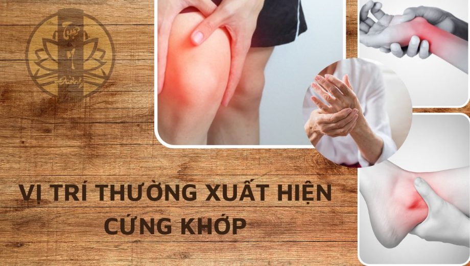 Cứng khớp thường xuất hiện ở đầu gối, khớp ngón táy, khớp cổ tay, cổ chân