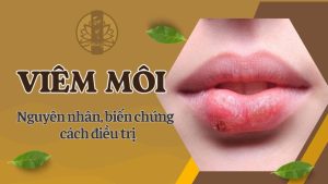 Viêm môi, nguyên nhân biến chứng và cách điều trị