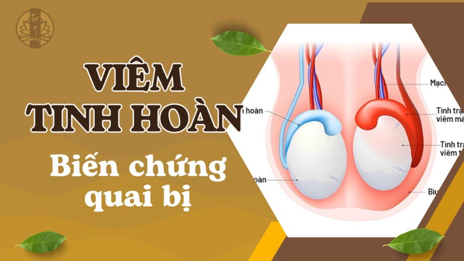 VIÊM TINH HOÀN - BIẾN CHỨNG QUAI BỊ