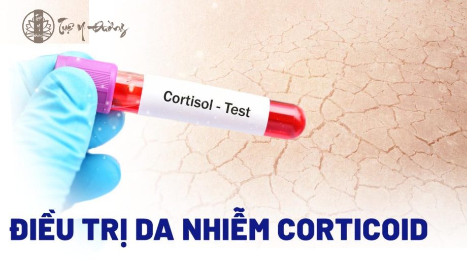 Điều trị da nhiễm corticoid