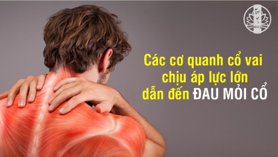 Các cơ quanh cổ vai chịu áp lực lớn dẫn đến các cơn đau mỏi cổ