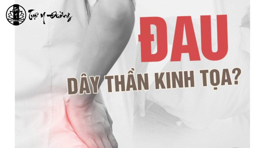 Cơn đau dây thần kinh tọa