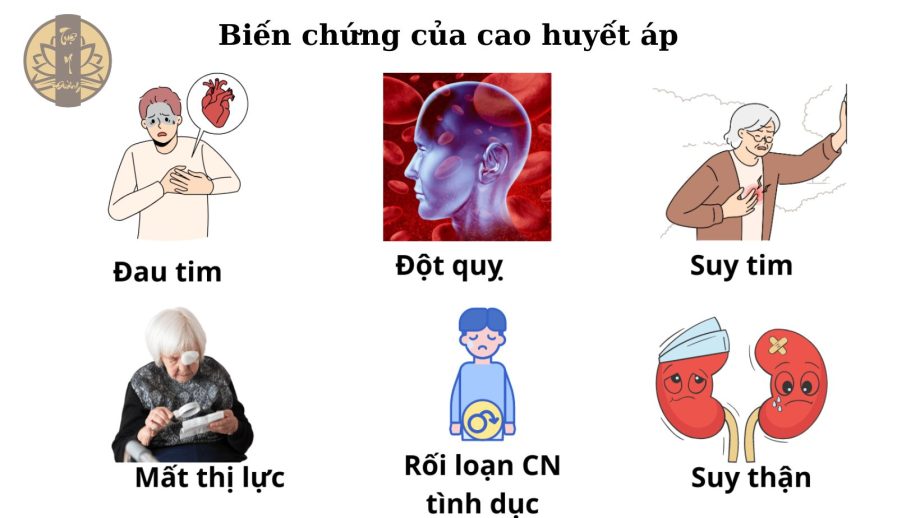 Biến chứng nguy hiểm của bệnh cao huyết áp