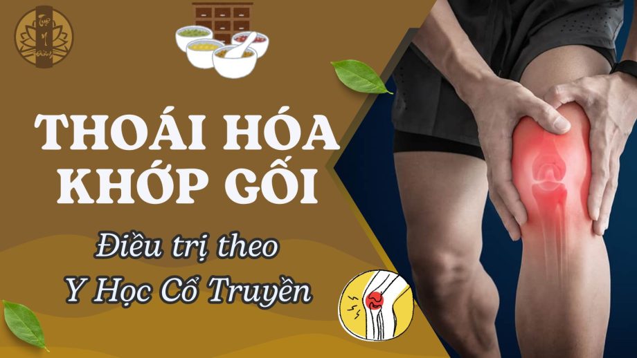 Thoái hóa khớp gối - Điều trị theo Y Học Cổ Truyền