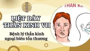 Liệt dây thần kinh VII- bệnh lý thần kinh ngoại biên tổn thương