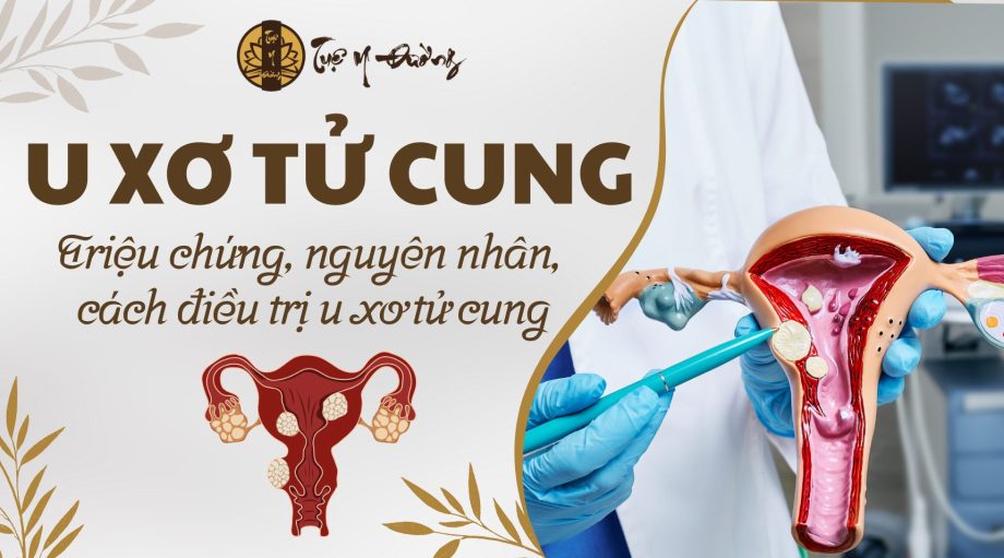 U xơ tử cung có nguy hiểm không? Triệu chứng, nguyên nhân cách điều trị u xơ tử cung