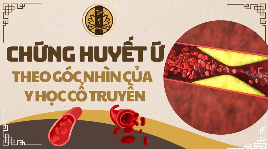 Chứng huyết ứ theo góc nhìn của y học cổ truyền