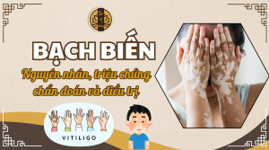 Bệnh Bạch Biến - Nguyên nhân, triệu chứng, chẩn đoán và cách điều trị