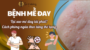Tại sao mề đay tái phát, cách điều trị mề đay theo từng thể tạng