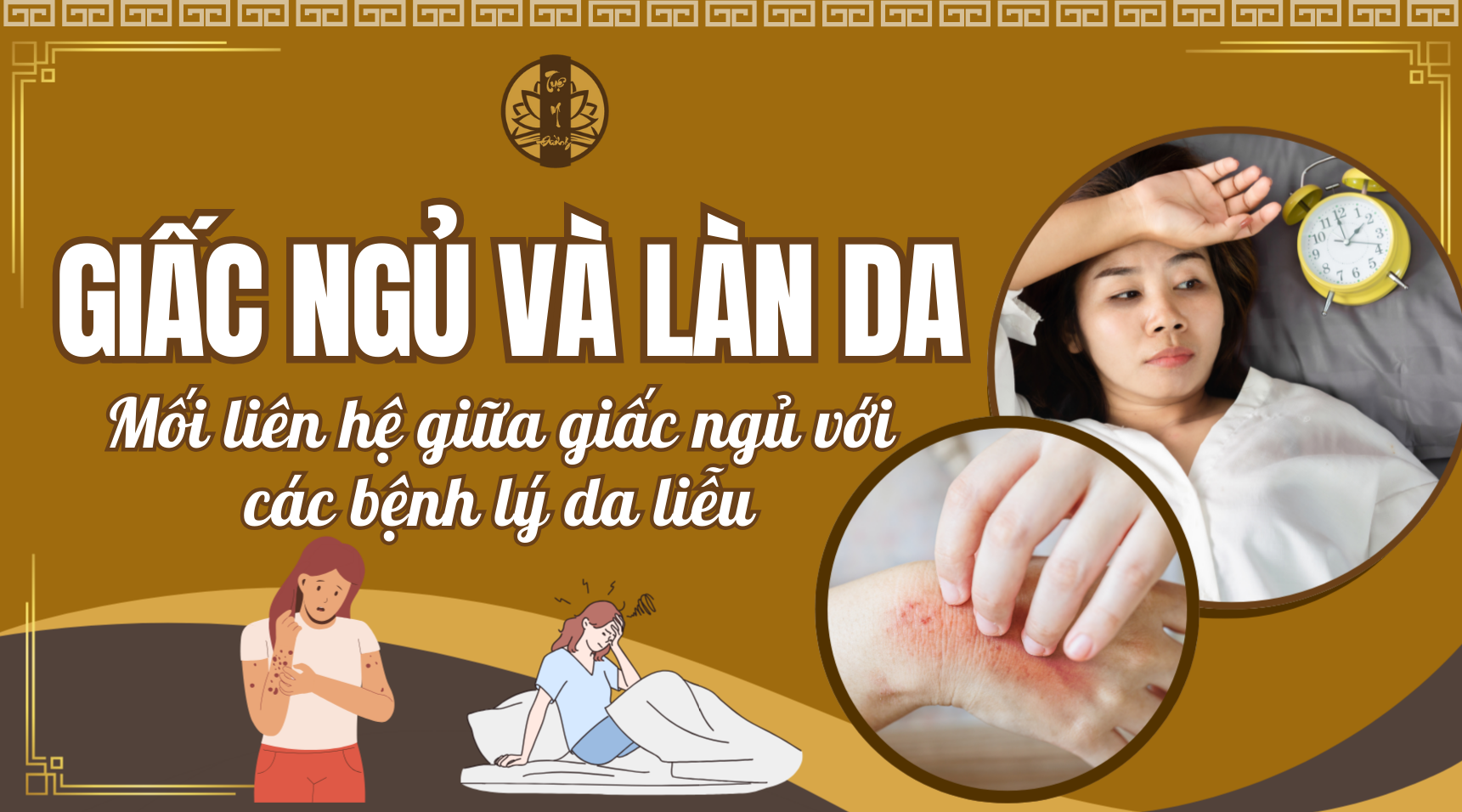 Mối liên hệ giữa giấc ngủ tinh thần và làn da