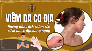 Viêm Da Cơ Địa - Cách chăm sóc da khi bị viêm da cơ địa