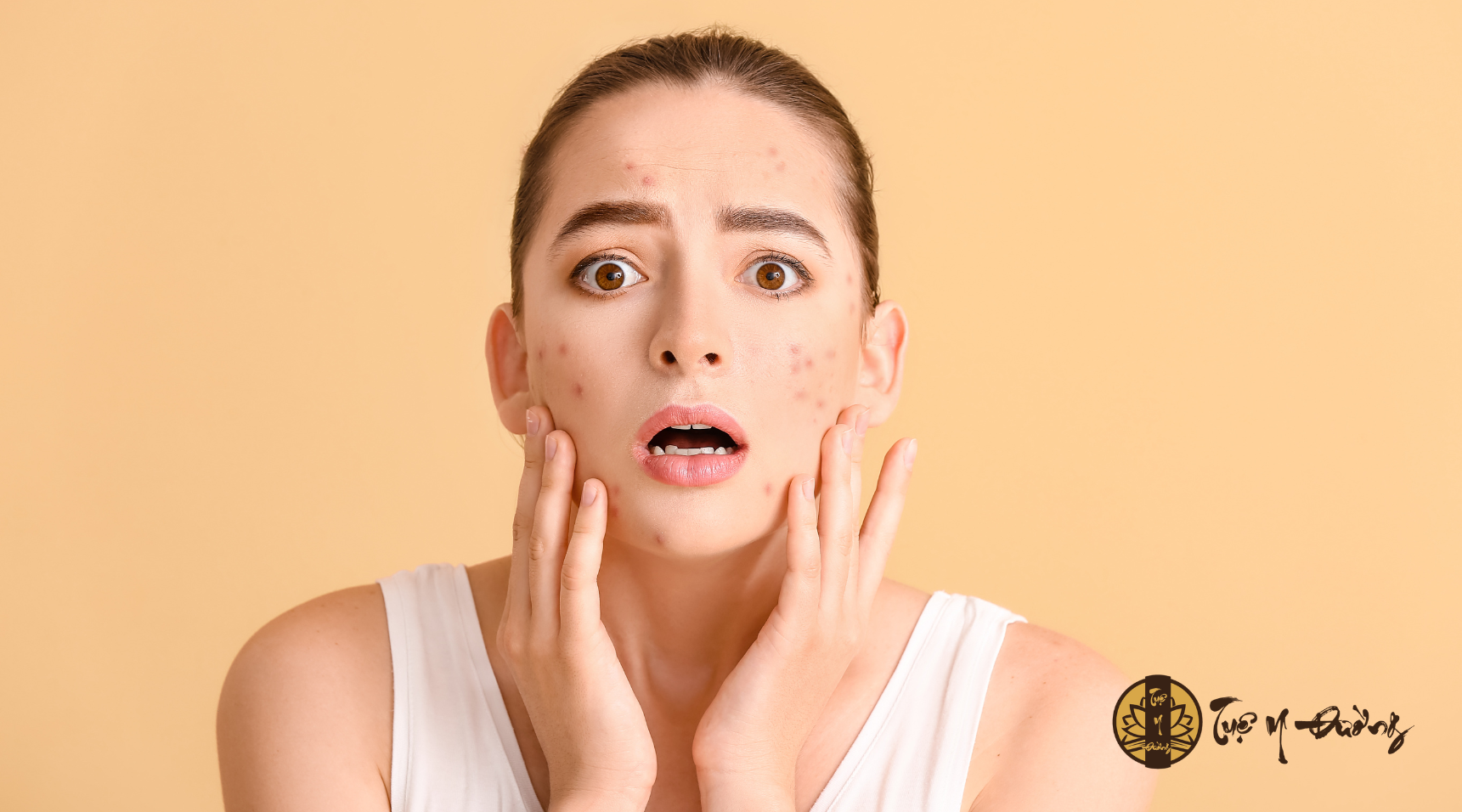 , một tinh thần u uất, căng thẳng kéo dài sẽ làm bệnh da liễu trở nên nặng nề hơn, khó điều trị dứt điểm.
