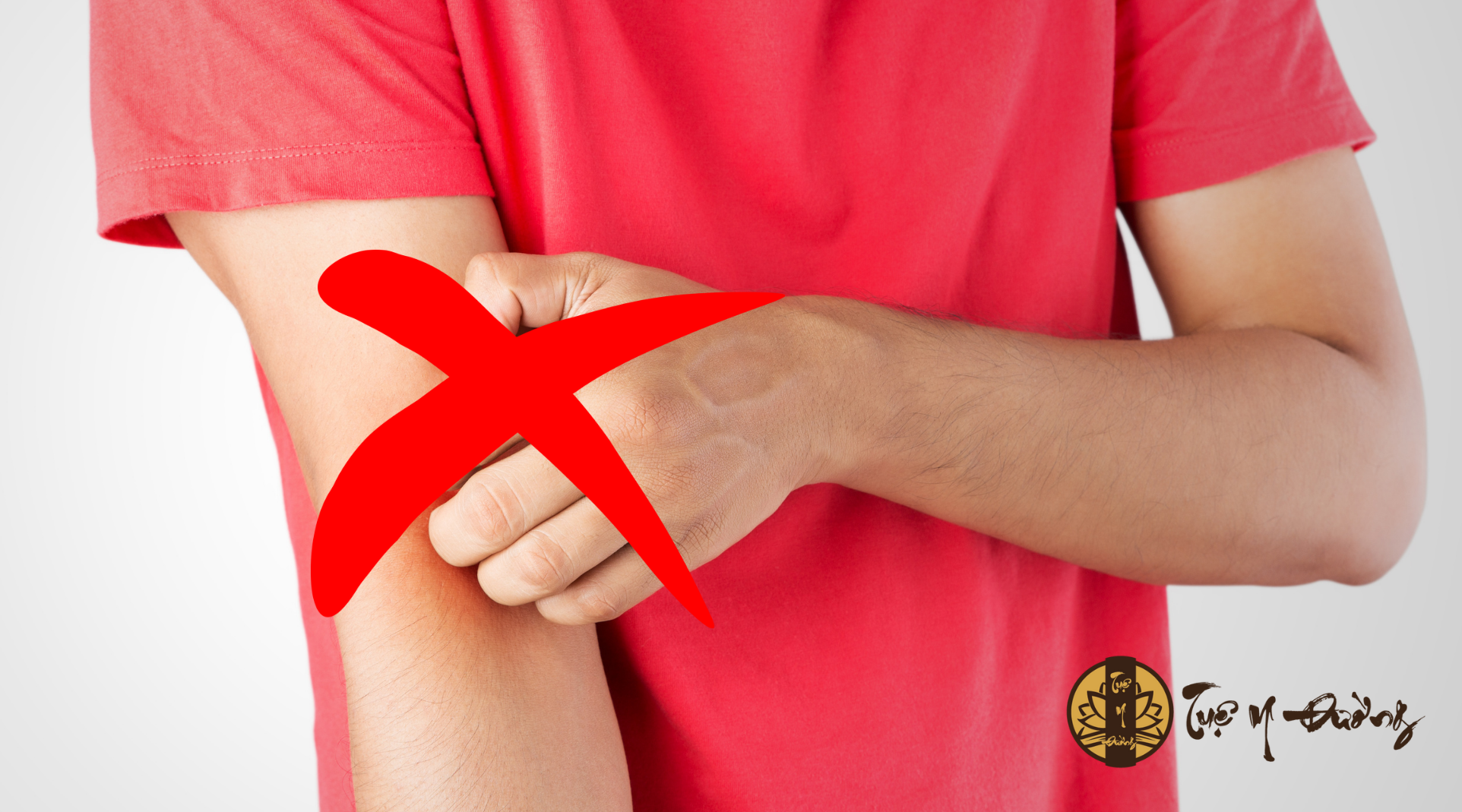 Giảm ngứa và tránh gãi – chìa khóa ngăn ngừa bội nhiễm