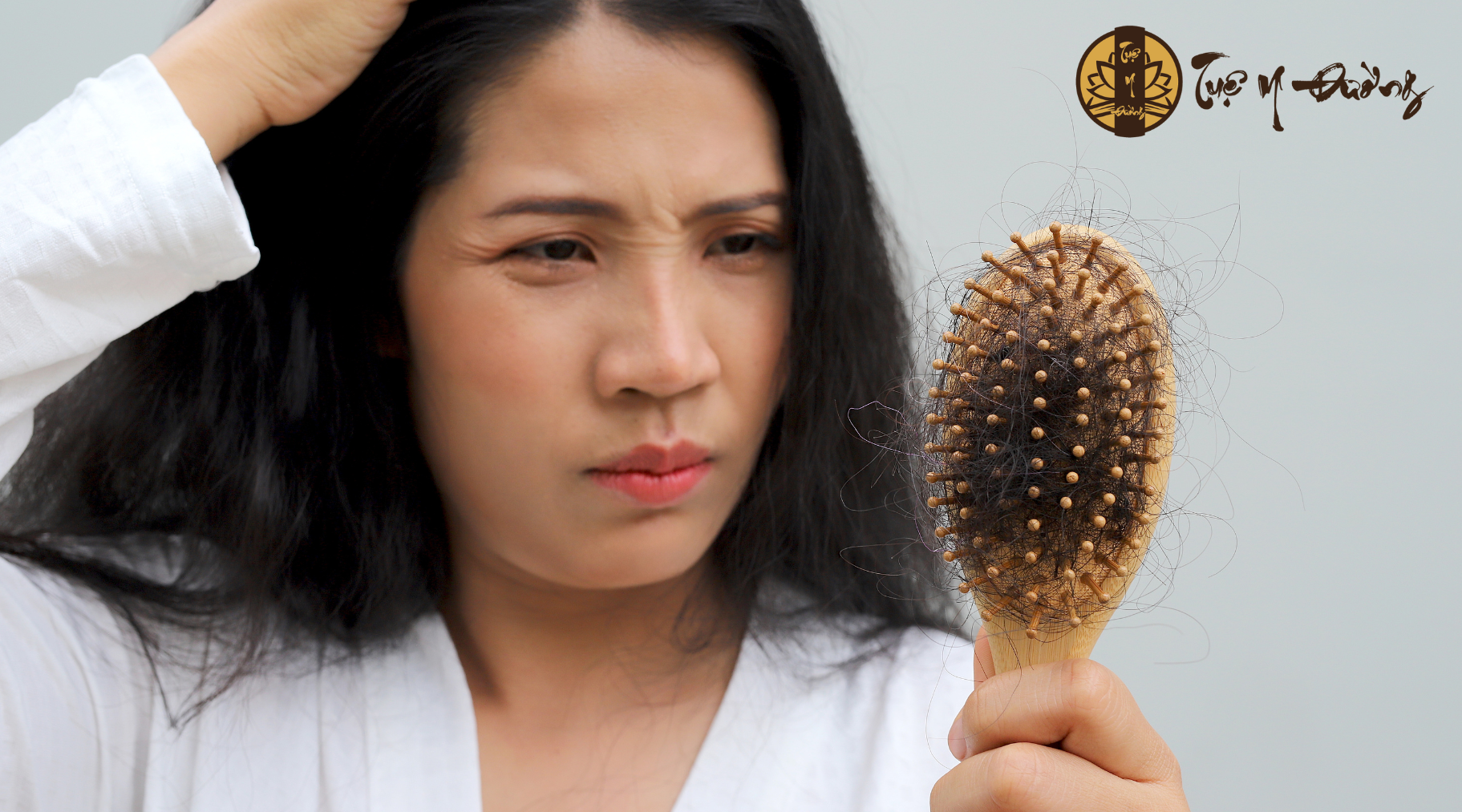 Tình trạng rụng tóc từng mảng nguyên nhân thường do Căng thẳng kéo dài: Stress, sang chấn tâm lý, mất ngủ.