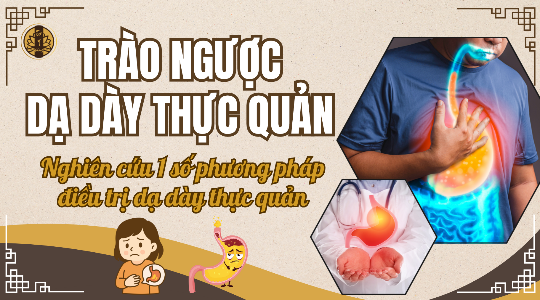 Trào ngực dạ dày thực quản - nghiên cứu một số phương pháp điều trị trào ngược dạ dày thực quản