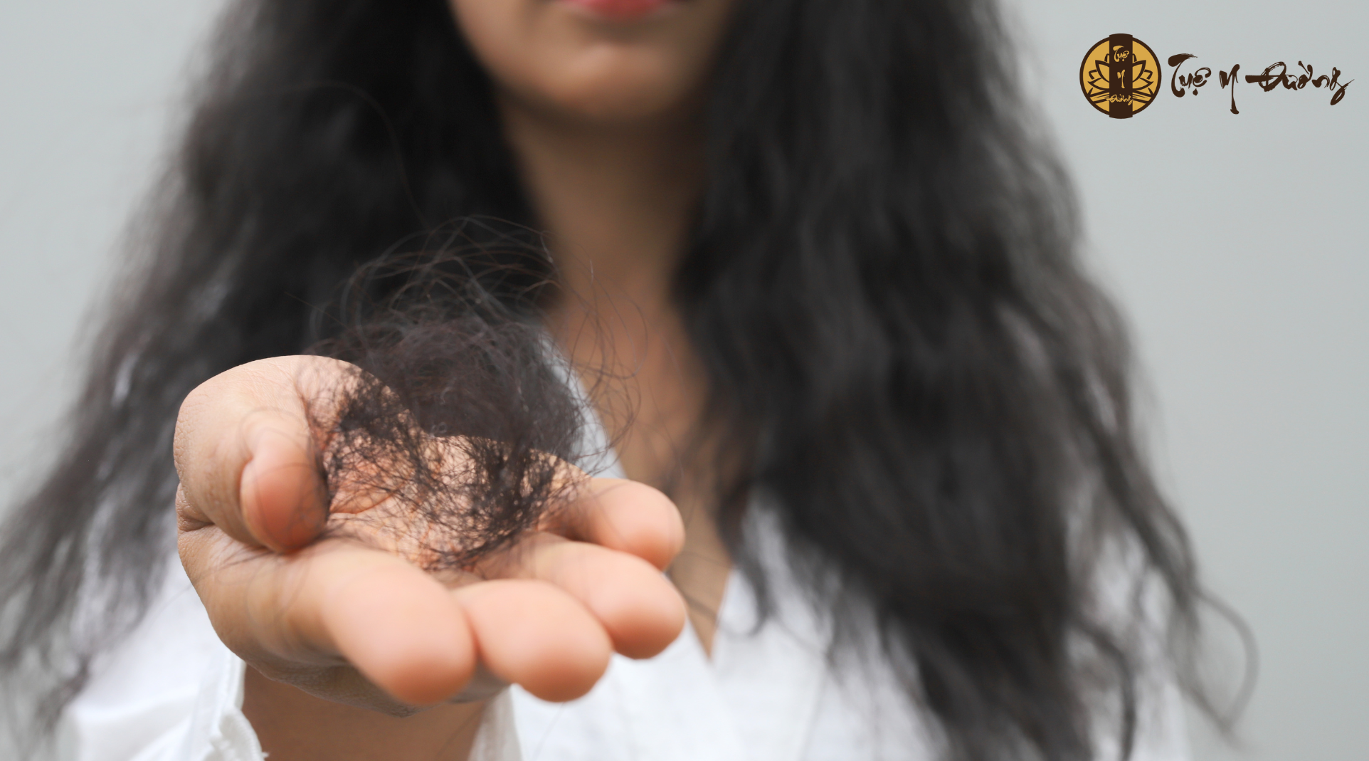 Tình trạng rụng tóc sau sinh