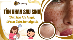 Tàn nhan sau sinh