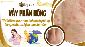 Vảy phấn hồng - thời tiết giao mùa ảnh hưởng đến vảy phấn hồng như thế nào